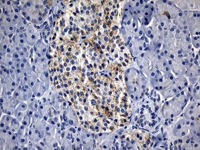 BAX Antibody in Immunohistochemistry (Paraffin) (IHC (P))