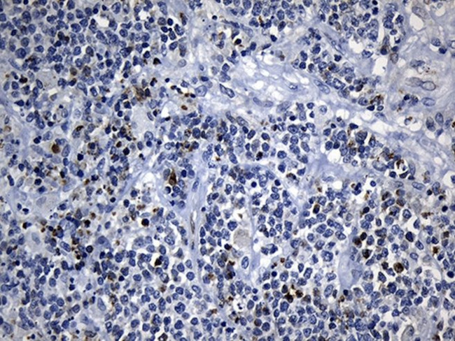 BAX Antibody in Immunohistochemistry (Paraffin) (IHC (P))