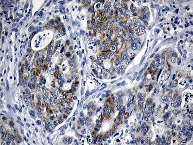 BAX Antibody in Immunohistochemistry (Paraffin) (IHC (P))