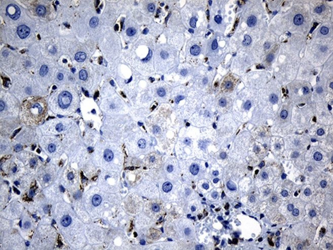 BAX Antibody in Immunohistochemistry (Paraffin) (IHC (P))