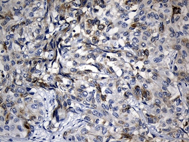 BAX Antibody in Immunohistochemistry (Paraffin) (IHC (P))