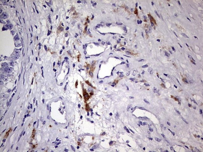 BAX Antibody in Immunohistochemistry (Paraffin) (IHC (P))