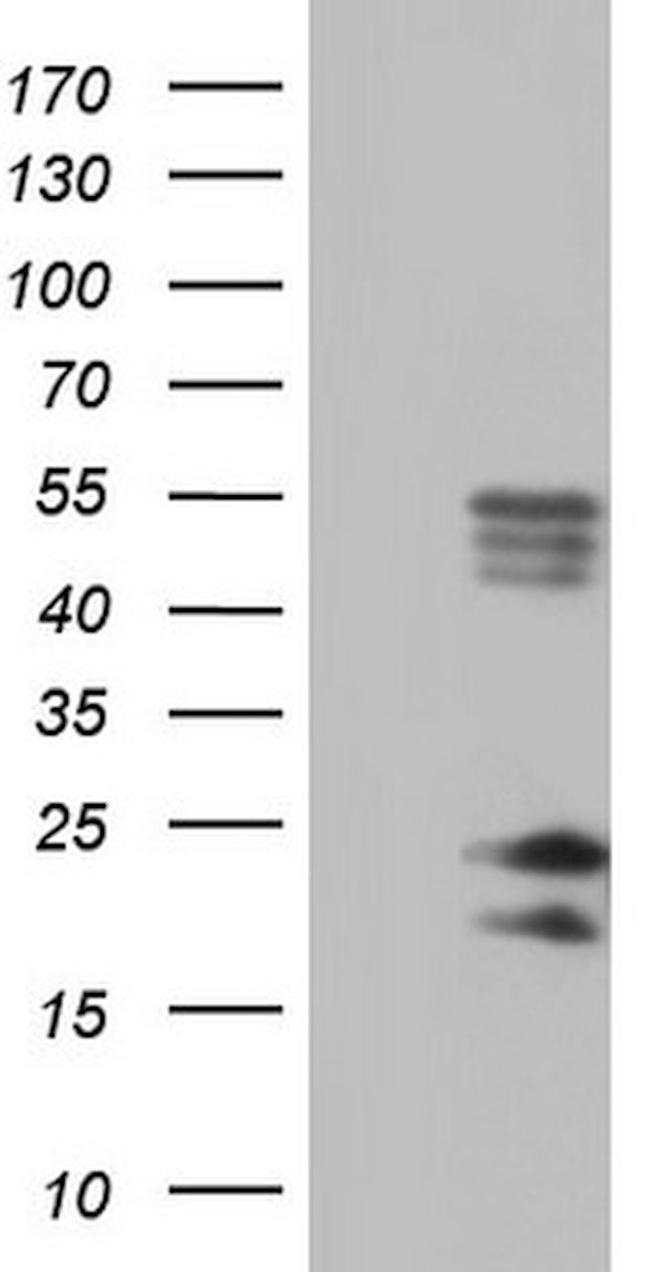 BAX Antibody in Western Blot (WB)