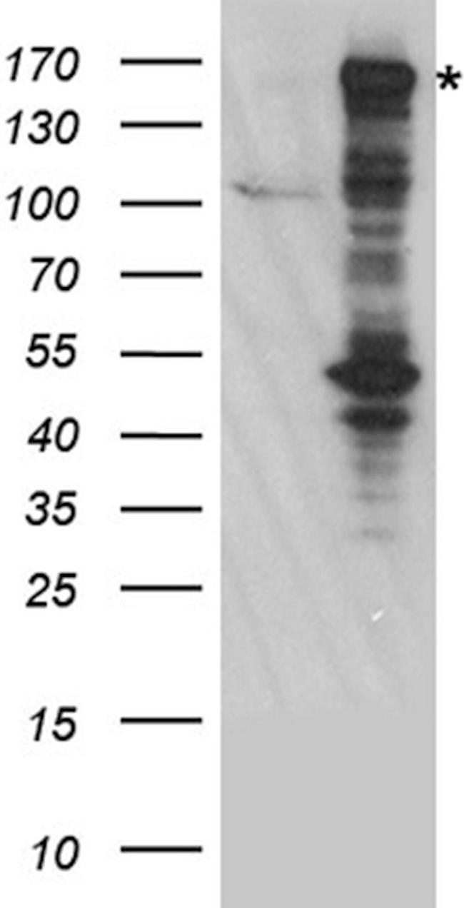 BAZ1B Antibody in Western Blot (WB)