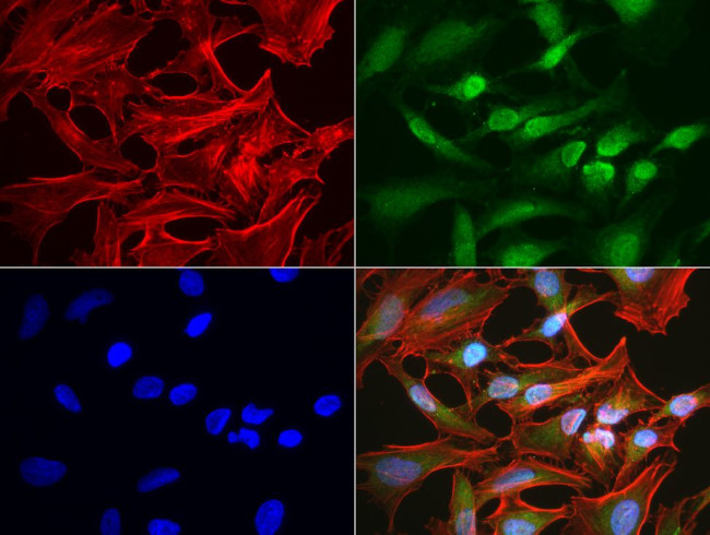 BBOX1 Antibody in Immunocytochemistry (ICC/IF)