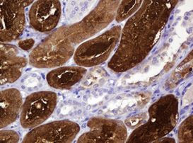 BBOX1 Antibody in Immunohistochemistry (Paraffin) (IHC (P))