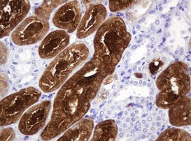 BBOX1 Antibody in Immunohistochemistry (Paraffin) (IHC (P))