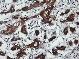 BBOX1 Antibody in Immunohistochemistry (Paraffin) (IHC (P))