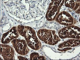 BBOX1 Antibody in Immunohistochemistry (Paraffin) (IHC (P))