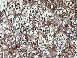 BBOX1 Antibody in Immunohistochemistry (Paraffin) (IHC (P))