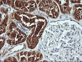 BBOX1 Antibody in Immunohistochemistry (Paraffin) (IHC (P))