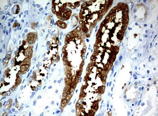 BBOX1 Antibody in Immunohistochemistry (Paraffin) (IHC (P))