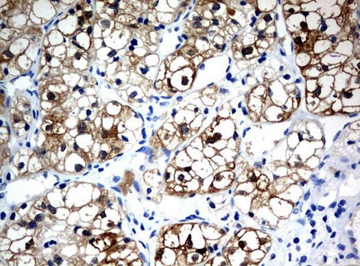 BBOX1 Antibody in Immunohistochemistry (Paraffin) (IHC (P))