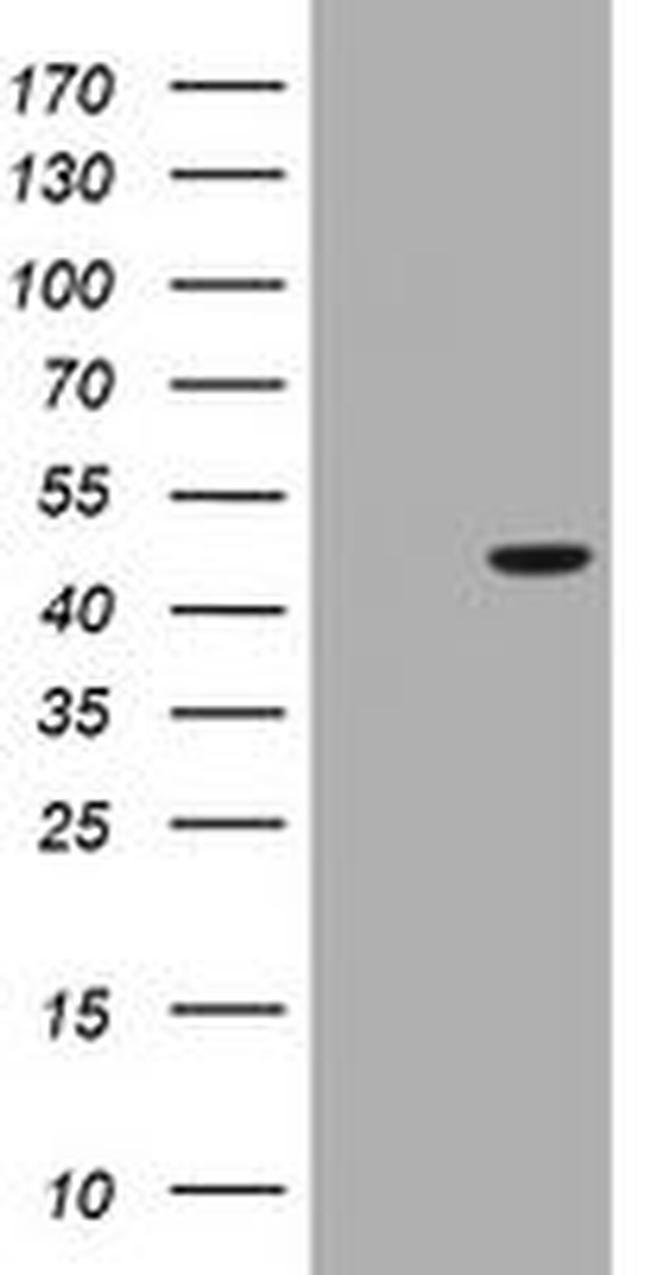 BBOX1 Antibody in Western Blot (WB)