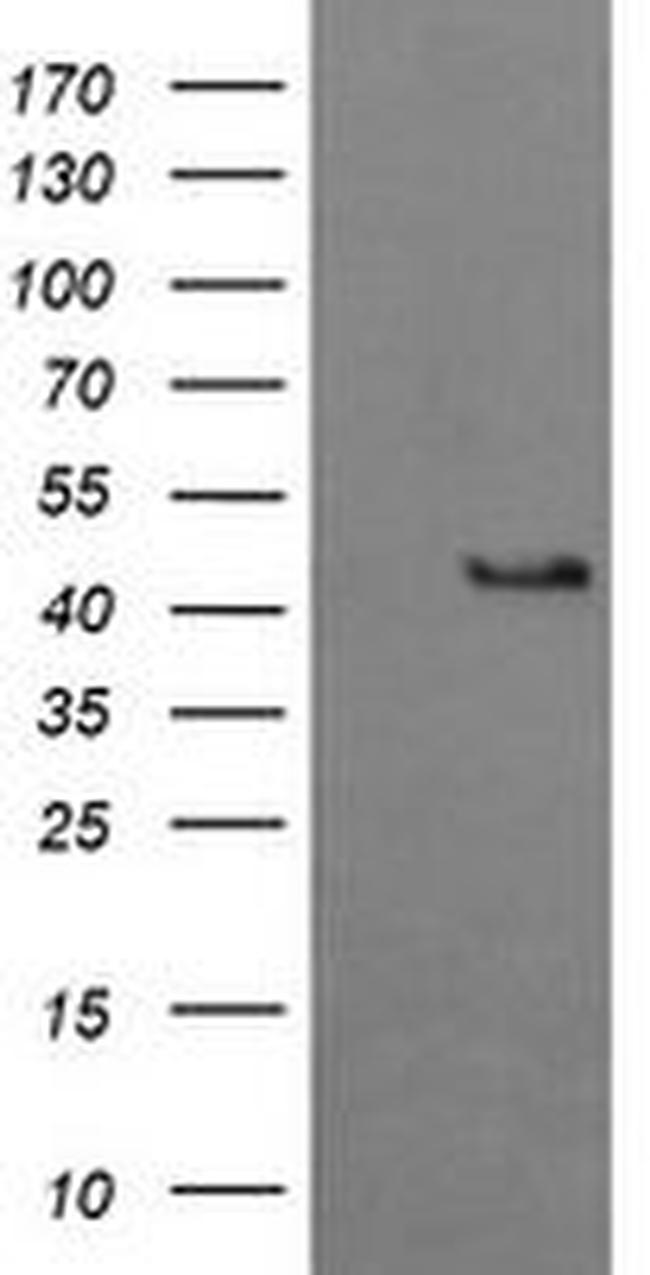 BBOX1 Antibody in Western Blot (WB)