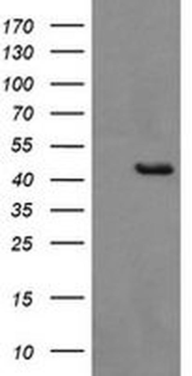 BBOX1 Antibody in Western Blot (WB)