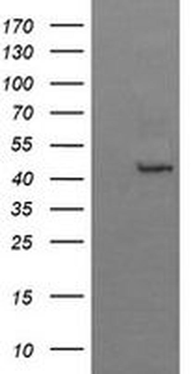 BBOX1 Antibody in Western Blot (WB)