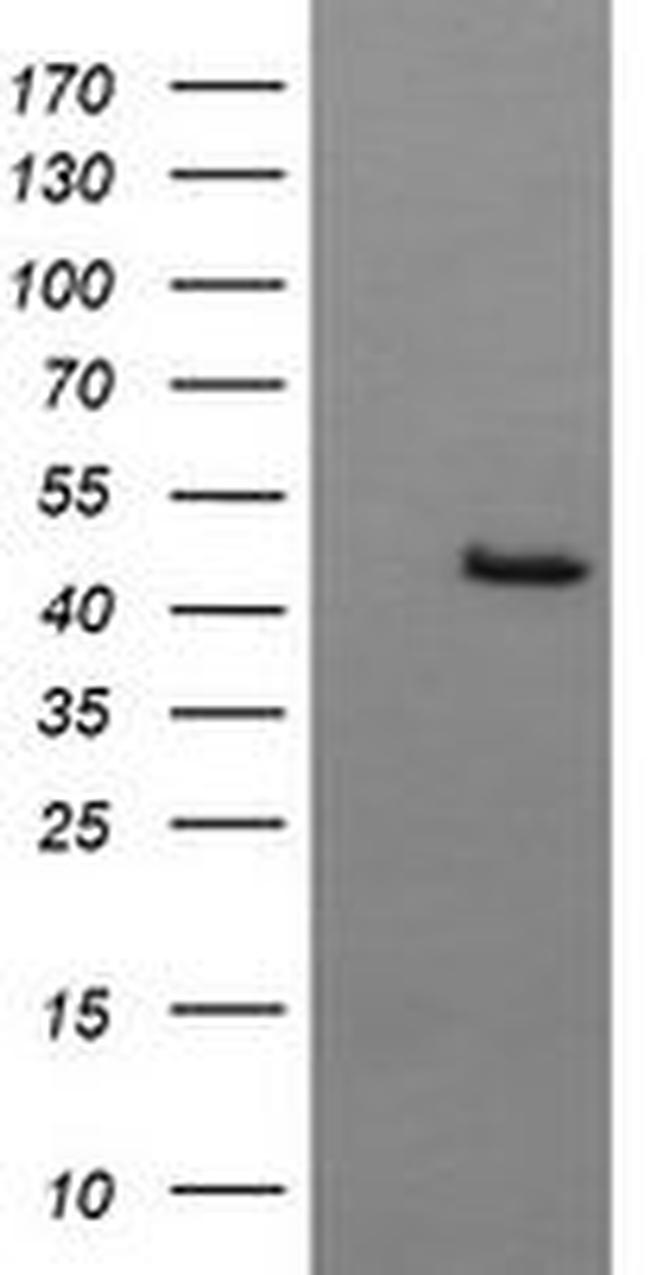 BBOX1 Antibody in Western Blot (WB)