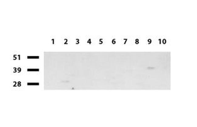 BBOX1 Antibody in Western Blot (WB)
