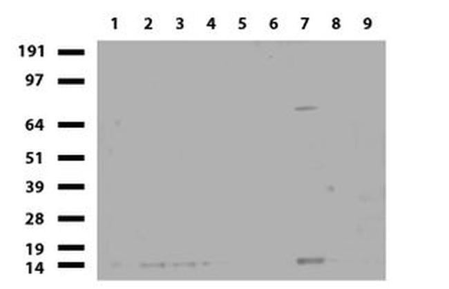 BBOX1 Antibody in Western Blot (WB)