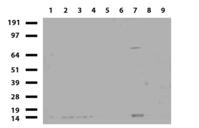 BBOX1 Antibody in Western Blot (WB)