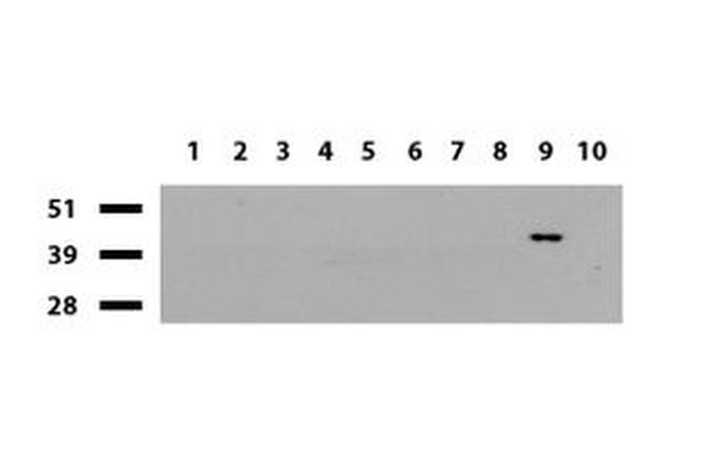 BBOX1 Antibody in Western Blot (WB)