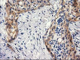 BCAR1 Antibody in Immunohistochemistry (Paraffin) (IHC (P))