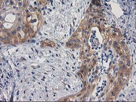 BCAR1 Antibody in Immunohistochemistry (Paraffin) (IHC (P))