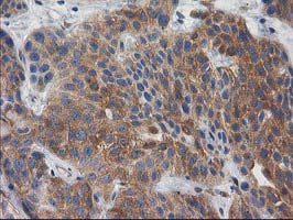 BCAR1 Antibody in Immunohistochemistry (Paraffin) (IHC (P))