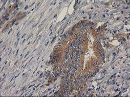 BCAR1 Antibody in Immunohistochemistry (Paraffin) (IHC (P))