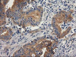 BCAR1 Antibody in Immunohistochemistry (Paraffin) (IHC (P))