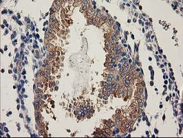 BCAR1 Antibody in Immunohistochemistry (Paraffin) (IHC (P))