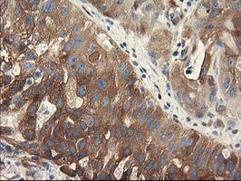 BCAR1 Antibody in Immunohistochemistry (Paraffin) (IHC (P))