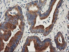 BCAR1 Antibody in Immunohistochemistry (Paraffin) (IHC (P))