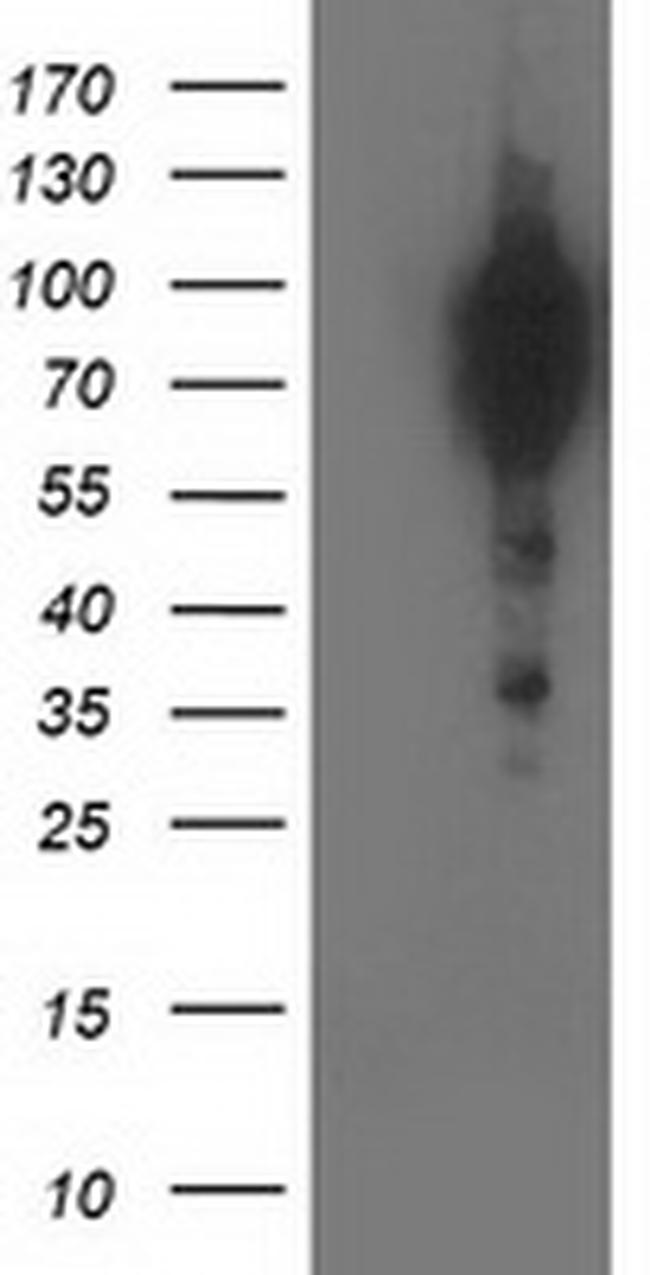 BCAR1 Antibody in Western Blot (WB)