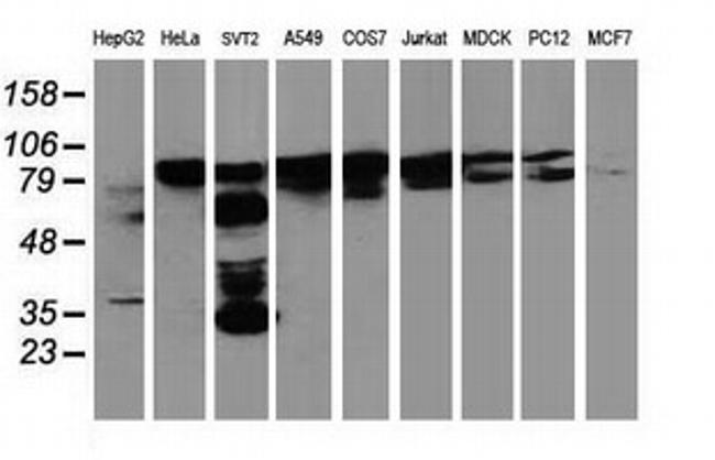 BCAR1 Antibody in Western Blot (WB)