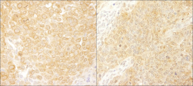 BCAR1/p130CAS Antibody in Immunohistochemistry (IHC)