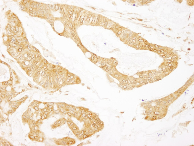 BCAR1/p130CAS Antibody in Immunohistochemistry (IHC)