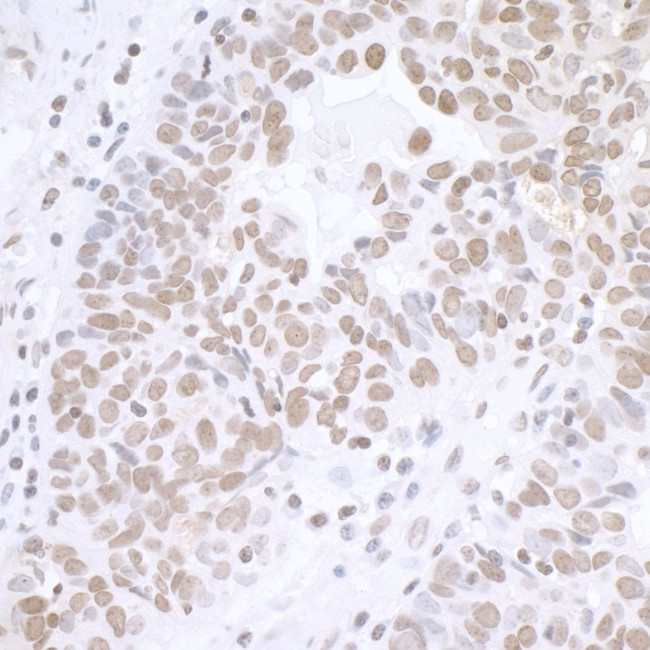 BCAS2 Antibody in Immunohistochemistry (IHC)