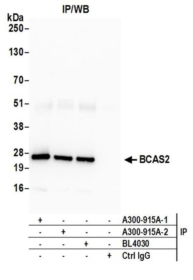 BCAS2 Antibody in Western Blot (WB)