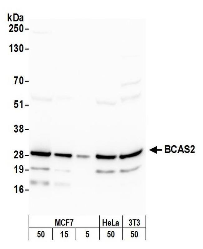 BCAS2 Antibody in Western Blot (WB)