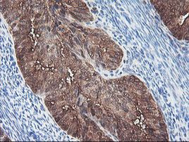 BCAT1 Antibody in Immunohistochemistry (Paraffin) (IHC (P))