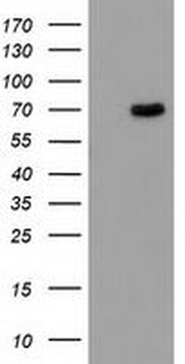 BCHE Antibody in Western Blot (WB)