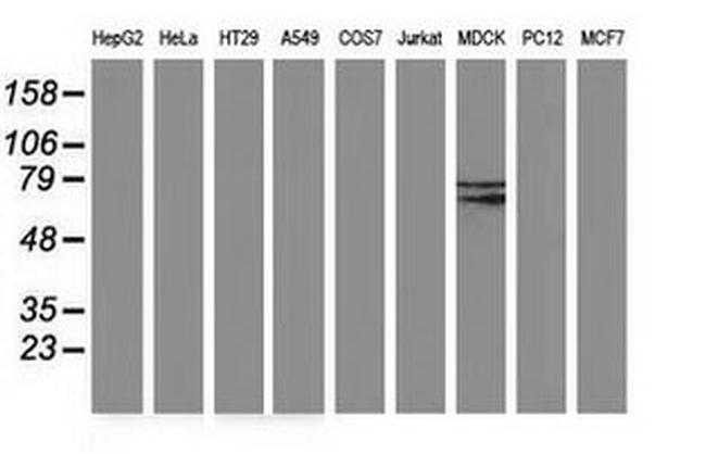 BCHE Antibody in Western Blot (WB)