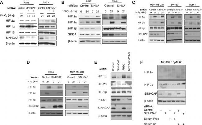 HIF-2 alpha Antibody in Western Blot (WB)