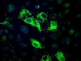 BCKDK Antibody in Immunocytochemistry (ICC/IF)