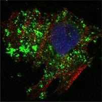 Bcl-10 Antibody in Immunocytochemistry (ICC/IF)