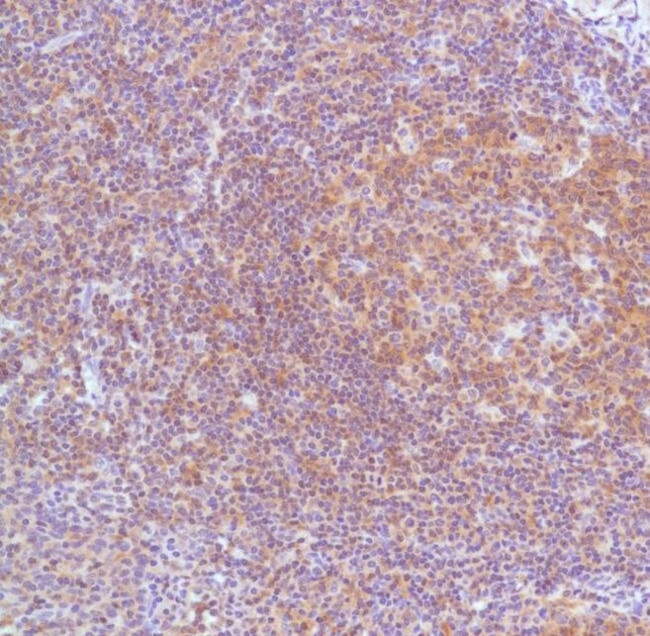 Bcl-10 Antibody in Immunohistochemistry (IHC)