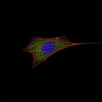 Bcl-2 Antibody in Immunocytochemistry (ICC/IF)