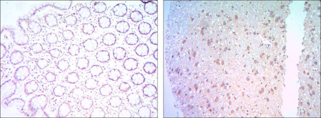 Bcl-2 Antibody in Immunohistochemistry (Paraffin) (IHC (P))